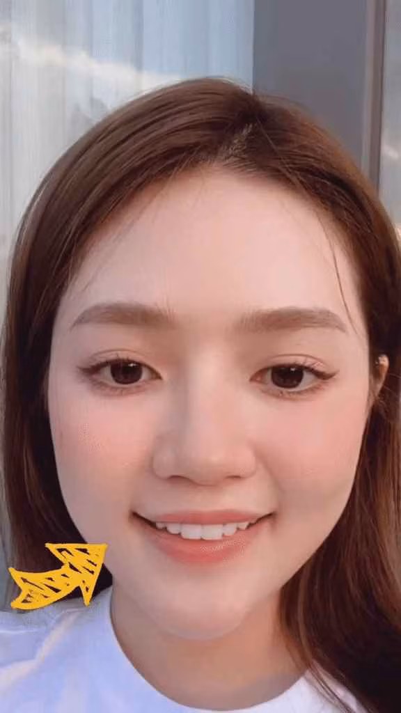 Mới đây, An Vy bất ngờ chia sẻ bản thân bị liệt dây thần kinh một bên mặt. Theo đó, cô nàng để ý thấy một bên má trái của mình bị hạ hơn so với má bên phải. Tổng thể khuôn mặt nhìn bị lệch, có phần đơ cứng nhẹ.