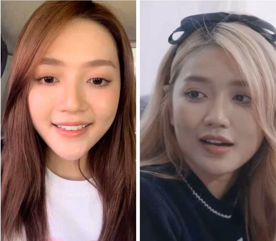 Ngoài ra trong các đoạn clip quay thời gian gần đây, An Vy thấy rõ miệng bị méo khi cười hay nói chuyện.