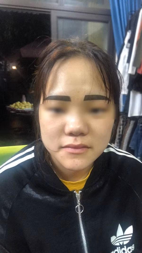 Mới đây, người dùng mạng xã hội tiếp tục xôn xao về cặp lông mày “bất ổn” sau khi đi “trùng tu” nhan sắc của một người phụ nữ khiến chồng chỉ biết “khóc thét”.