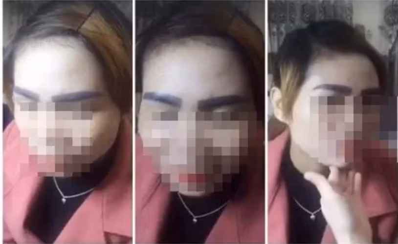 Không chỉ xấu về mặt thẩm mỹ, chủ nhân của những cặp lông mày hỏng còn bị ảnh hưởng đến tinh thần, trở nên tự ti về bản thân.