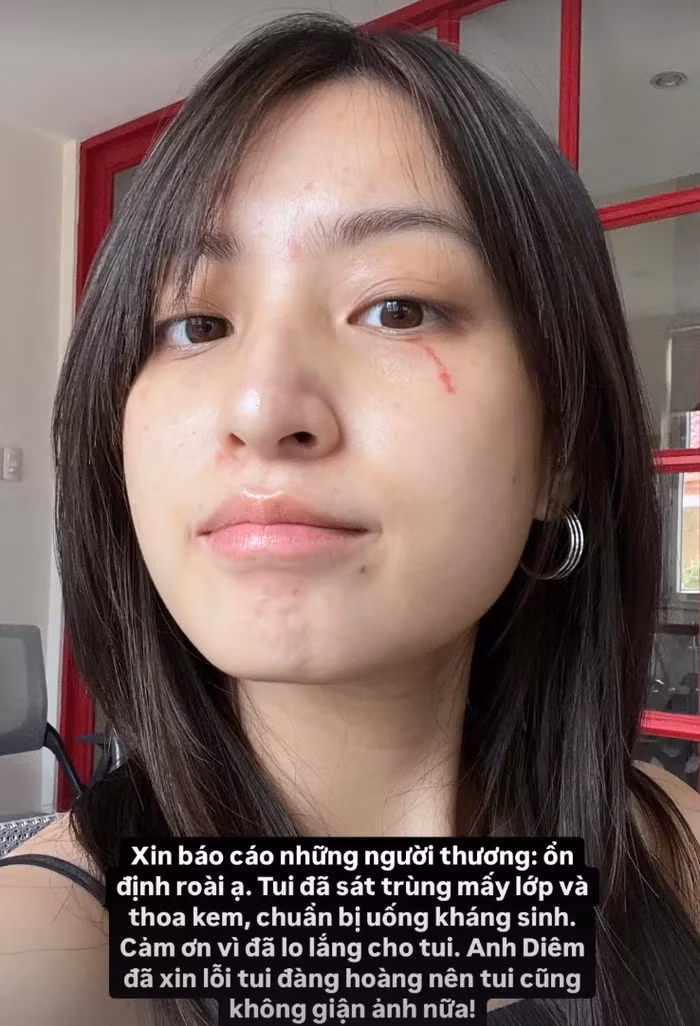 Trước tình trạng này của Thảo Tâm, nhiều khán giả đã ra sức hỏi thăm nữ diễn viên.