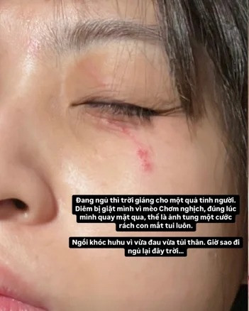 "Ngồi khóc huhu vì vừa đau vừa tủi thân. Giờ sao đi ngủ lại đây trời", nàng hot girl IELTS buồn bã nói thêm.