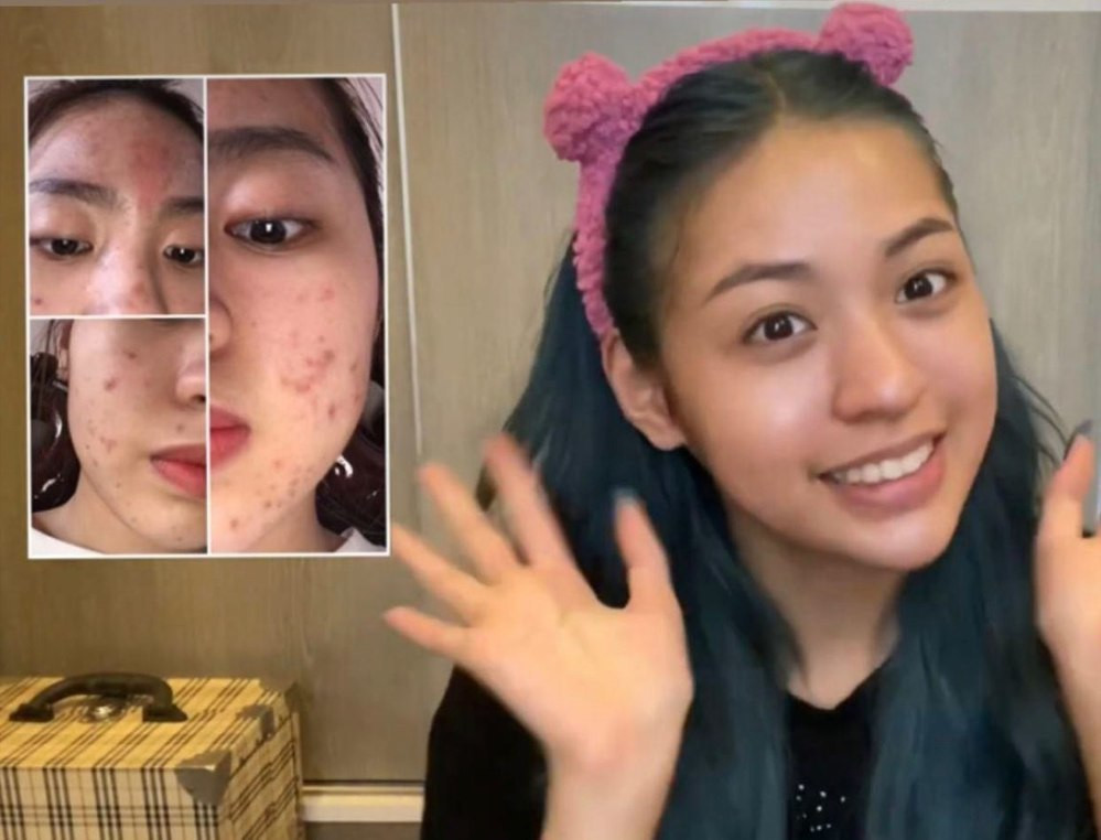 Từ khi có mặt tại cuộc thi, Trần Thanh Tâm để lại nhiều ấn tượng bởi nhan sắc thật khá chất lượng. Tuy không lộng lẫy và chỉn chu như trên mạng xã hội, hot girl TikTok lại chiếm trọn cảm tình bởi đường nét gương mặt tự nhiên xinh xắn, cùng vai trần gợi cảm được khoe khéo trong bộ cánh cắt xẻ "nhẹ tay".