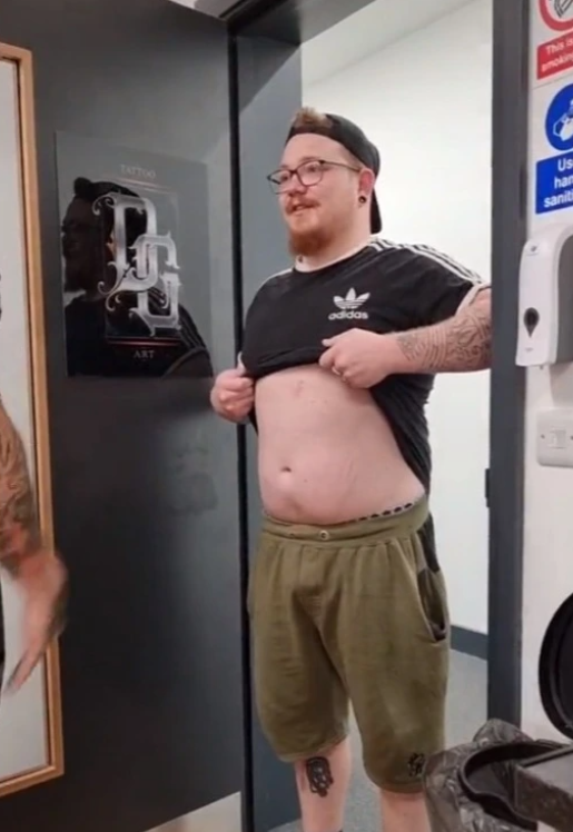 Được biết, trước đó người đàn ông này cũng từng tìm đến các phương pháp tập thể hình như vừa không đem lại hiệu quả lại mệt mỏi.