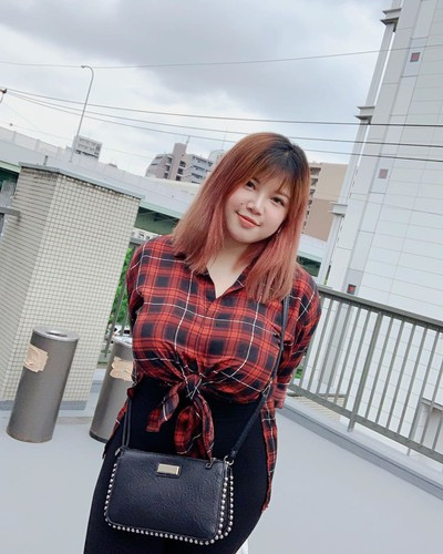 Sau khi phẫu thuật, bác sĩ Nguyễn Văn Hưng cho biết đã đưa ra khỏi cơ thể 10X khoảng 6 lít mỡ.