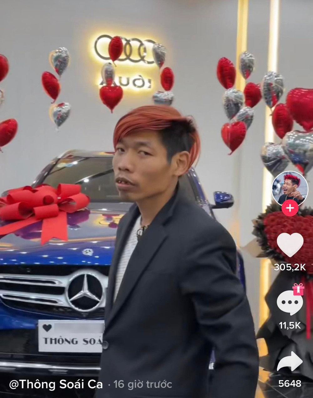 Vốn diện sơ mi trắng cùng quần jeans đơn giản, lịch sự, nhưng hot TikToker lại phối hợp với đôi dép tông màu xanh neon nổi bật trông thật lạc quẻ.