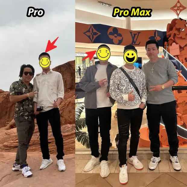 Khoa Pug tu tay dang anh truoc va sau khi keo chan 5 ty