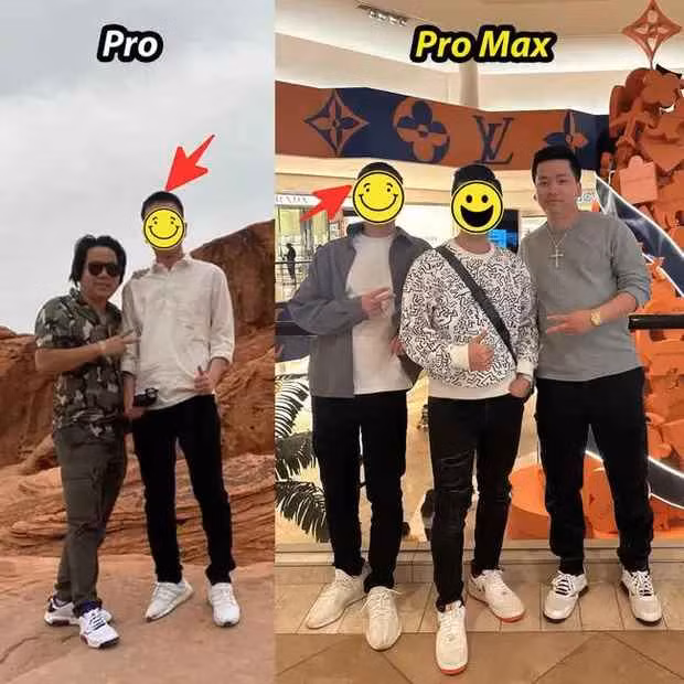 Khoa Pug tu tay dang anh truoc va sau khi keo chan 5 ty