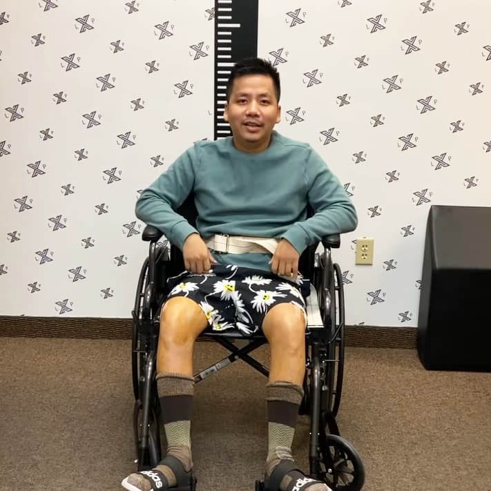 Tháng 6/2022, Youtuber nổi tiếng Khoa Pug khiến dư luận bàn tán xôn xao khi chia sẻ hành trình kéo chân để tăng chiều cao tại Mỹ.