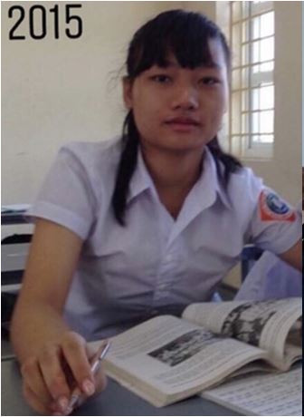 Năm 2015, khi còn là học sinh cấp 3, Thảo sở hữu nhan sắc kém nổi bật, mọi đường nét trên gương mặt đều thiếu cân đối: mặt vuông, mũi to, đôi mắt không rõ mí, cằm ngắn, làn da ngăm đen và mái tóc bù xù...