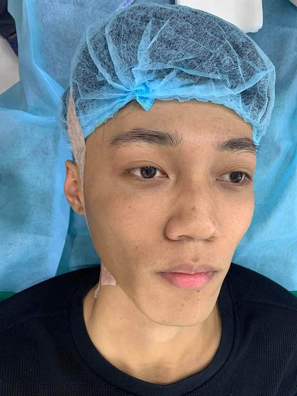 Trước khi có diện mạo "hoàng tử bạch mã", Hoài Thương sở hữu làn da đen nhẻm, khuôn mặt không có gì nổi bật trong quá khứ, vì vậy 10X tìm đến dao kéo để thay đổi số phận.