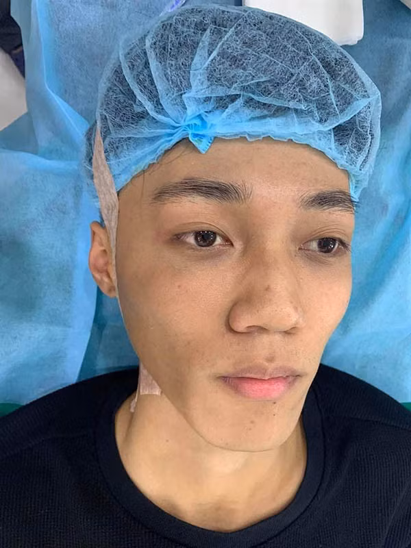 Trước khi có diện mạo "hoàng tử bạch mã", Hoài Thương sở hữu làn da đen nhẻm, khuôn mặt không có gì nổi bật trong quá khứ, vì vậy 10X tìm đến dao kéo để thay đổi số phận.