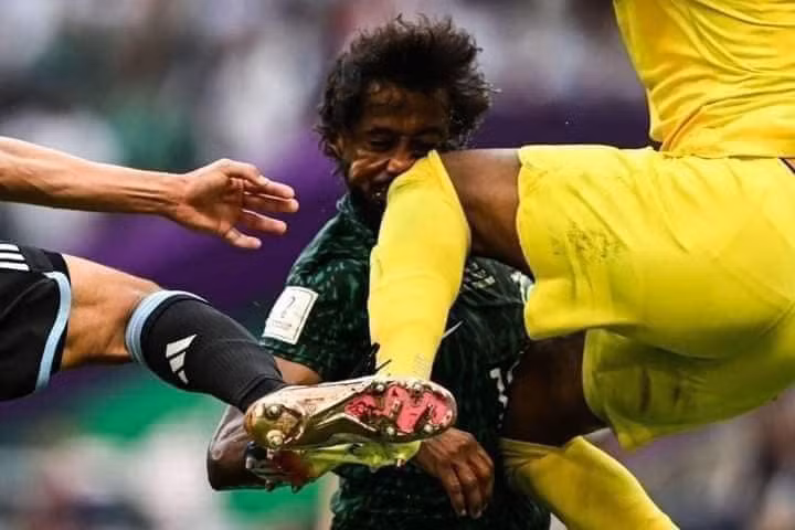 Để có được chiến thắng lịch sử trước đội tuyển Argentina, các cầu thủ của Saudi Arabia đã phải đổ mồ hôi và cả máu. Những phút cuối trận đấu, cầu thủ Yasser Al-Shahrani, hậu vệ cánh, đã va chạm với thủ môn đội nhà.