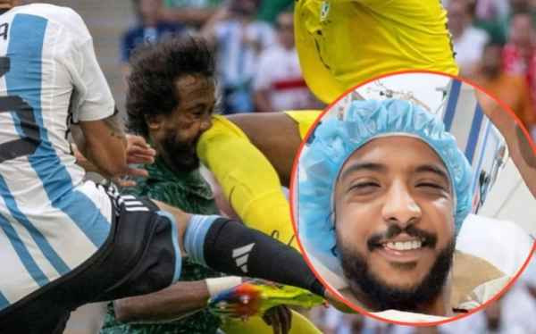 Theo các bác sĩ, anh đã bị đa chấn thương vùng mặt. Cụ thể: Vỡ xương hàm dưới, vỡ xương hốc mắt, vỡ xương mũi, gãy răng.