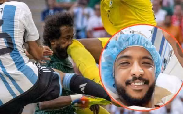 Theo các bác sĩ, anh đã bị đa chấn thương vùng mặt. Cụ thể: Vỡ xương hàm dưới, vỡ xương hốc mắt, vỡ xương mũi, gãy răng.