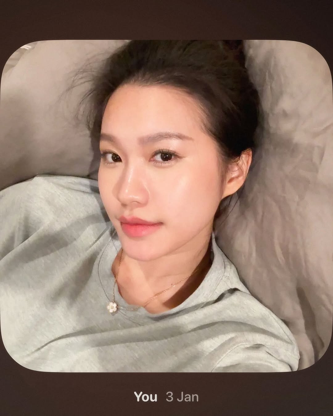 Đôi môi hiện tại của Doãn Hải My đã có độ mềm mại, bóng nhẹ làm nổi bật vẻ căng tràn sức sống.