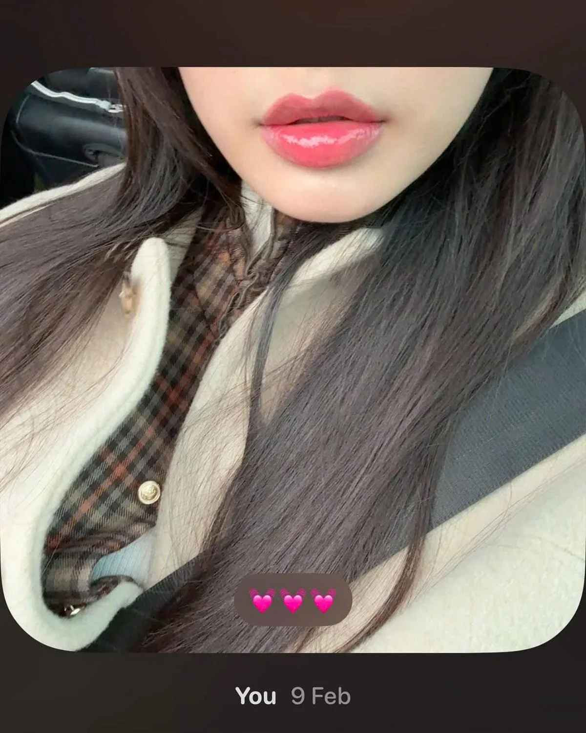 Qua hình ảnh, có thể thấy đôi môi của Doãn Hải My đã dần ổn định sau quá trình phun.