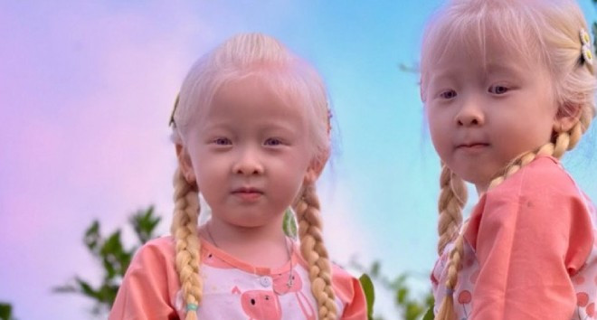 Lúc này cộng đồng mạng ủng hộ nhiệt tình, hễ có video nào đều “cày view” video đó với mục đích: theo dõi sự trưởng thành của cặp song sinh, mong kinh tế gia đình khá giả hơn.