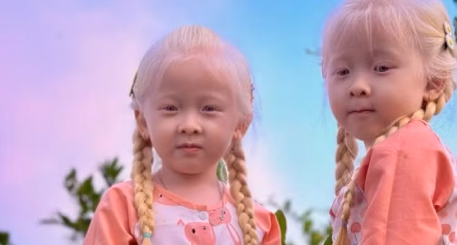 Lúc này cộng đồng mạng ủng hộ nhiệt tình, hễ có video nào đều “cày view” video đó với mục đích: theo dõi sự trưởng thành của cặp song sinh, mong kinh tế gia đình khá giả hơn.