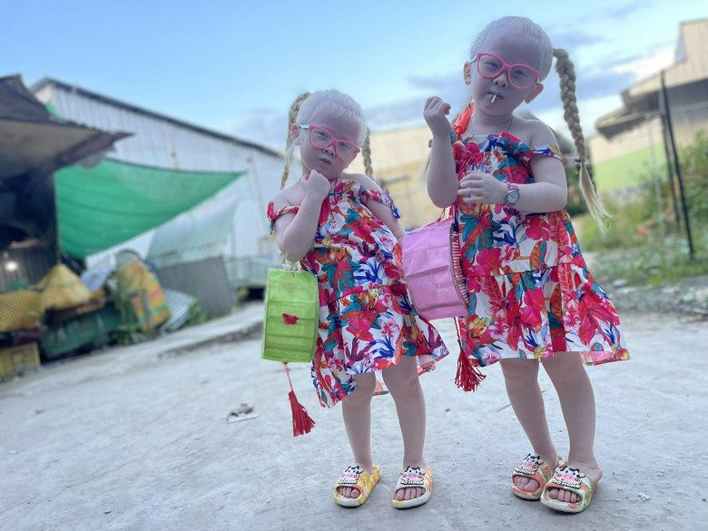 Gia đình Tâm Chị - Tâm Em được một YouTuber nổi tiếng giúp đỡ, thành lập kênh YouTube mang tên “Song sinh thiên thần”, do anh Mây chị Rồng – cha mẹ của hai bé quản lý.