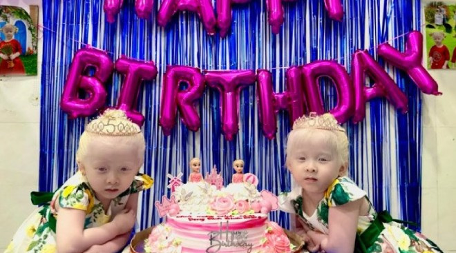 Hiện tại kênh YouTube của cặp song sinh bạch tạng này đạt 174.000 lượt theo dõi với 347 video cùng hàng trăm nghìn lượt xem.