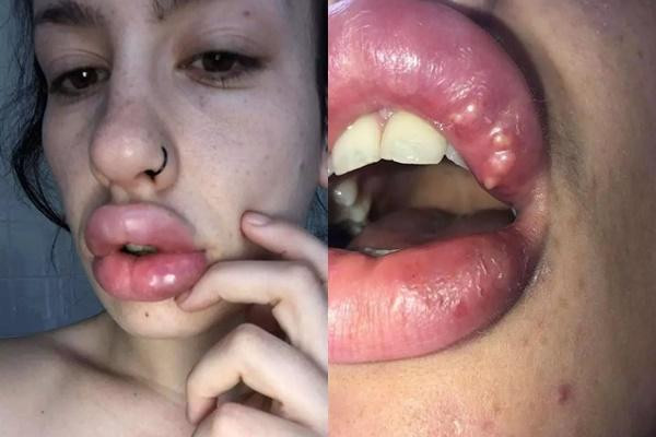 Lời khuyên, nếu muốn làm đẹp nhờ công nghệ khuyên mọi người nên đến các cơ sở y tế có uy tín và được cấp phép.