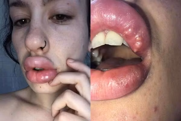 Lời khuyên, nếu muốn làm đẹp nhờ công nghệ khuyên mọi người nên đến các cơ sở y tế có uy tín và được cấp phép.