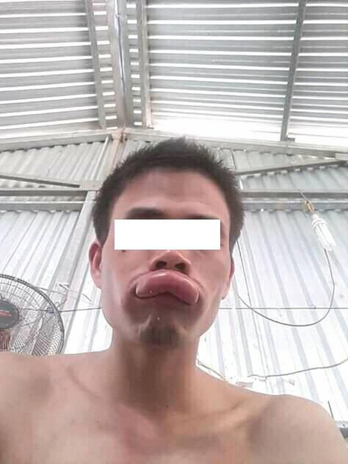 Ngay sau khi được chia sẻ, bài viết anh chàng thợ sửa mạng bị ong đốt nhanh chóng trở thành tâm điểm chú ý và gây xôn xao cộng đồng mạng.