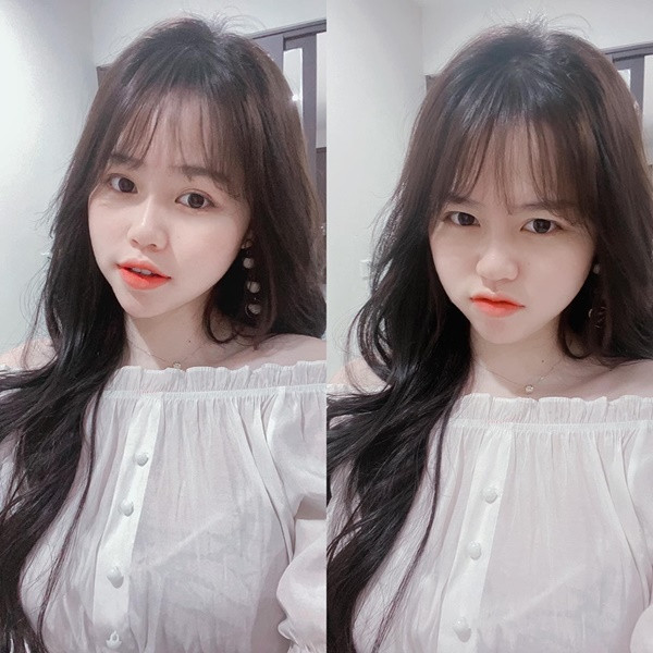 Về màn sửa răng đắt đỏ của Huỳnh Anh cũng có một số ý kiến cho rằng, cô nàng chỉ đang tân trang lại cho đẹp hơn mà thôi vì đúng là răng của cô bạn không đẹp lắm.