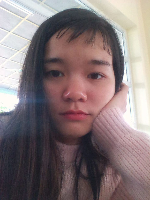 Giống như các nạn nhân tội nghiệp dưới đây chẳng hạn, một giây đưa kéo nhầm là không muốn nhìn mặt mình luôn...