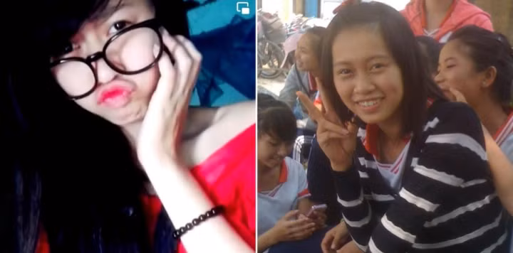 Người đẹp chia sẻ: "Sau 1 tiếng rưỡi 'dao kéo' giây phút mình nhìn thấy chiếc mũi hoàn thiện thì rất xúc động, không nghĩ là đẹp như vậy. Hai tuần sau mũi lòi sụn màu trắng ra, da không liền lại. Bác sĩ sau đó mới nói phải tháo mũi ra làm lại, tiếc quá, tháo ra thì mũi sẽ xấu hơn mũi lúc đầu...