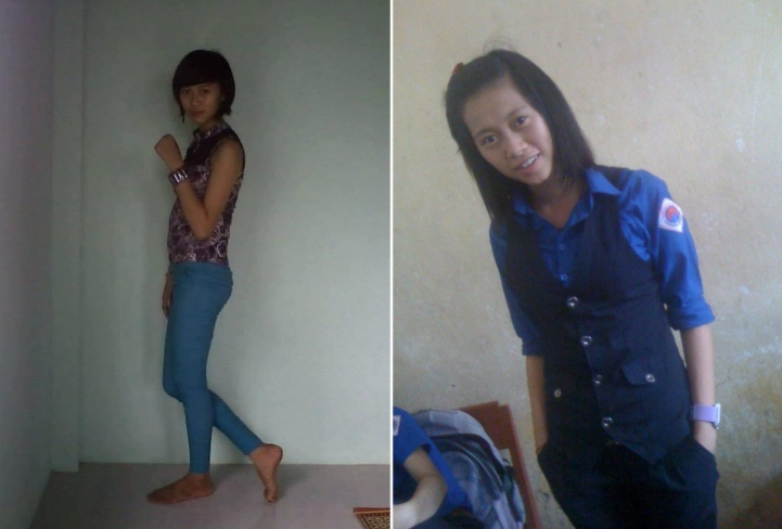 Theo đó, Việt Phương Thoa cho biết bản thân thời tuổi teen có khao khát hoạt động giải trí song khá tự ti về diện mạo, đặc biệt là chiếc mũi tẹt.