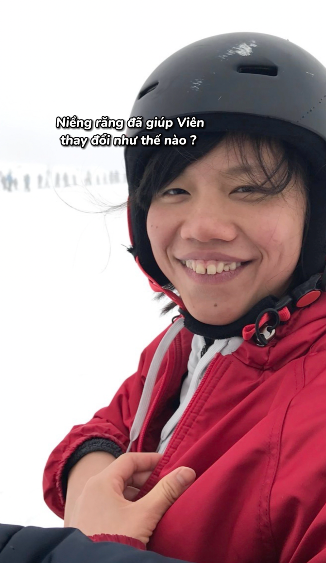 Mặc dù ngoại hình xinh đẹp là vậy nhưng Ánh Viên cũng chẳng ngại dìm nhan sắc bản thân. Mới đây, "tiểu tiên cá" đã công khai những hình ảnh gây sốc của mình ở thời chưa niềng răng và dán sứ.