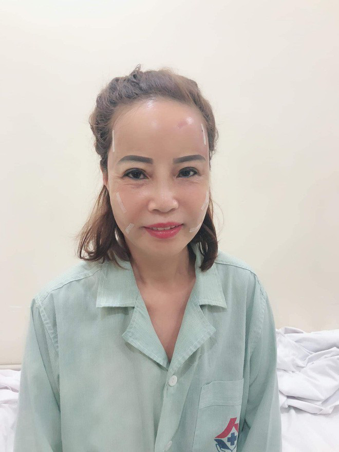 Tuy nhiên, chứng kiến hình ảnh mới của cô dâu 62 tuổi, dân tình thay vì háo hức lại tỏ ra lo lắng cho gương mặt mới của chị Sao khi vừa sưng, vừa biến dạng, miệng lại méo sang một bên rõ ràng.
