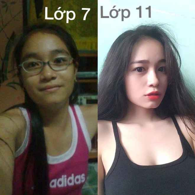 Từng có thời điểm, trend khoe "dậy thì thành công" vô cùng hot trên mạng xã hội.