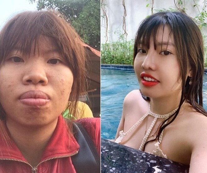 Quách Thị Kim Phượng (SN 1996, quê Đắk Nông) là bà mẹ đơn thân nổi đình đám mạng xã hội năm 2017. Cô tự nhận mình là “Thị Nở tái sinh”, hơn 20 năm sống trong tự ti với gương mặt nhiều khuyết điểm như mũi tẹt, gò má cao, hàm hô, môi dày, da mụn… và ly hôn chồng cũng vì thế.