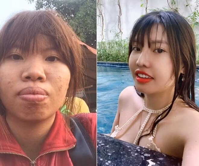 Quách Thị Kim Phượng (SN 1996, quê Đắk Nông) là bà mẹ đơn thân nổi đình đám mạng xã hội năm 2017. Cô tự nhận mình là “Thị Nở tái sinh”, hơn 20 năm sống trong tự ti với gương mặt nhiều khuyết điểm như mũi tẹt, gò má cao, hàm hô, môi dày, da mụn… và ly hôn chồng cũng vì thế.