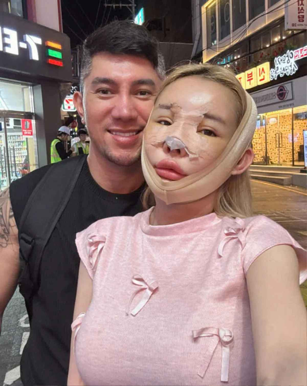 "Mấy đợt trước tôi cũng có nói đi thẩm mỹ muốn làm sao để nhìn mặt của tôi nét nào ra nét đấy, trông phải đứng tuổi và dữ lên tí xíu. Còn lần này, tôi đi sửa cho nó hiền lại. Chắc là tôi không dám sửa nữa đâu, không dám làm ca đại phẫu nữa đâu vì ca vừa rồi quá đau", Ngân 98 cho hay.