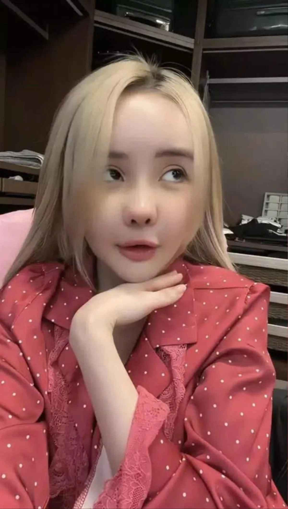 Sau 1 tháng sang Hàn phẫu thuật thẩm mỹ, Ngân 98 đã gặp sự cố. Cụ thể, phần sụn mũi của cô rơi vào tình trạng bị co rút sụn.