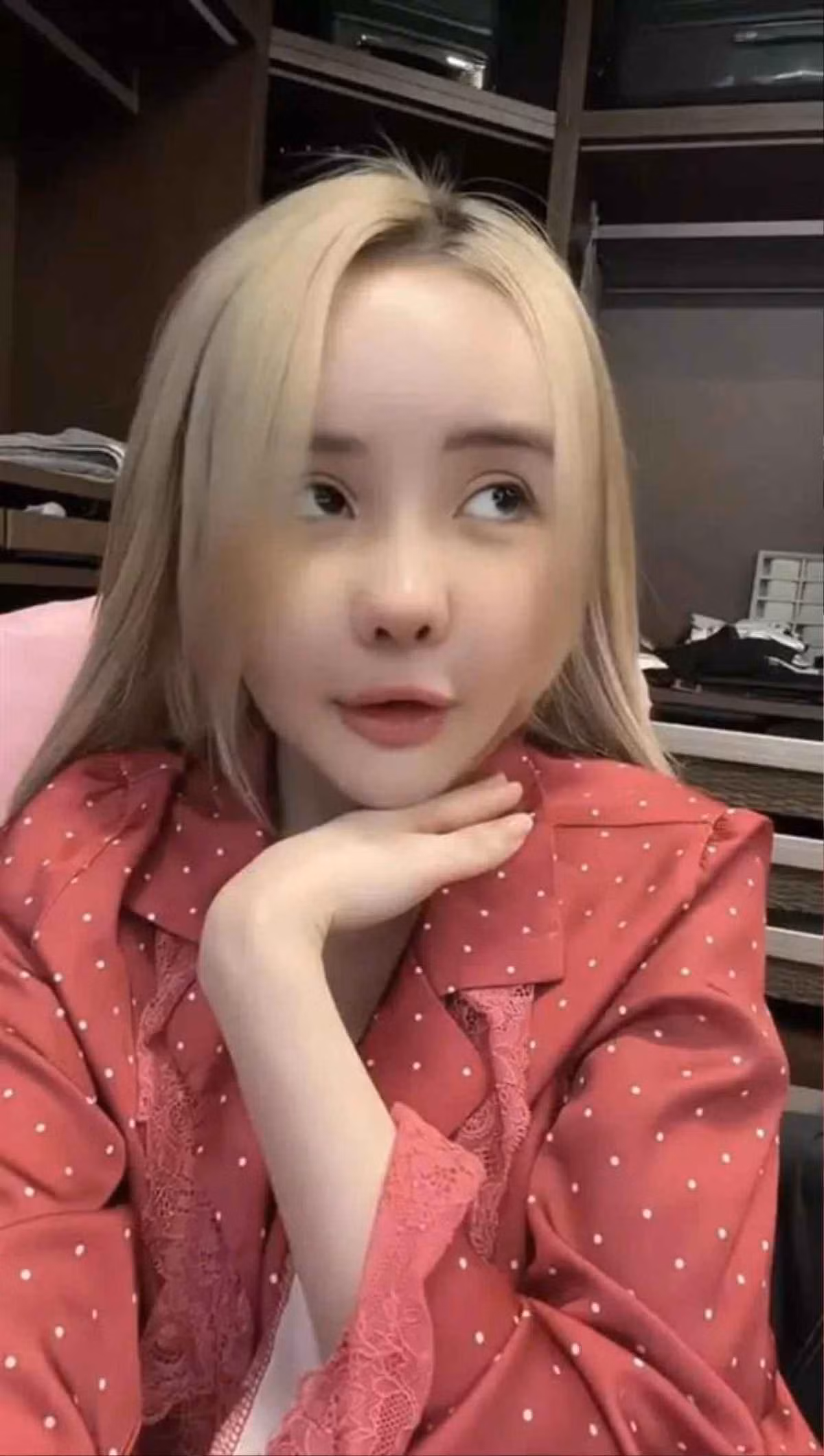 Sau 1 tháng sang Hàn phẫu thuật thẩm mỹ, Ngân 98 đã gặp sự cố. Cụ thể, phần sụn mũi của cô rơi vào tình trạng bị co rút sụn.