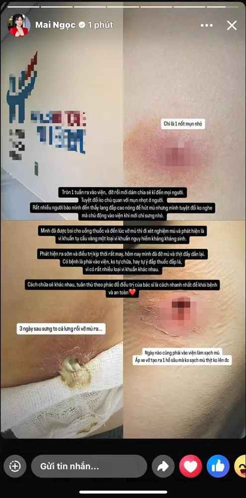 Nữ MC nhắc nhở mọi người nên cẩn trọng về mọi vấn đề liên quan đến sức khoẻ, cần được thăm khám và điều trị kịp thời.