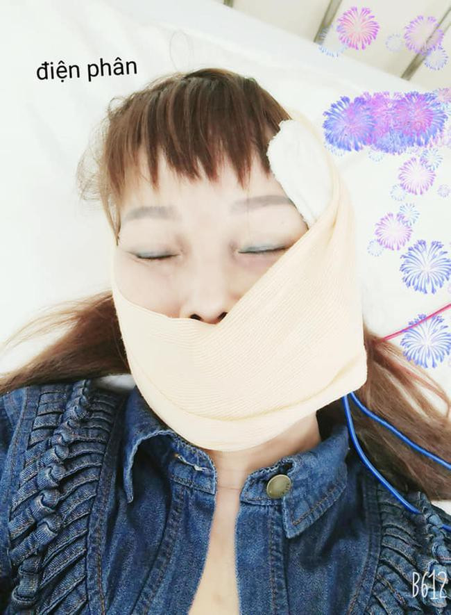 Cô Thu Sao đã có làn da căng mịn hơn trước nhưng chị để lộ sự mất cân đối trên mặt, vì khuôn miệng bị méo hẳn về một bên.