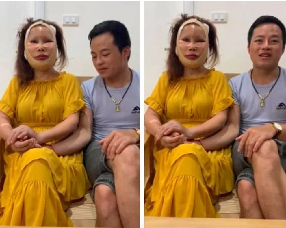 Từ khi kết hôn với chồng trẻ 26 tuổi, cô dâu 62 tuổi ở Cao Bằng Lê Thị Thu Sao thường xuyên dùng đến phẫu thuật thẩm mỹ để níu kéo thanh xuân.