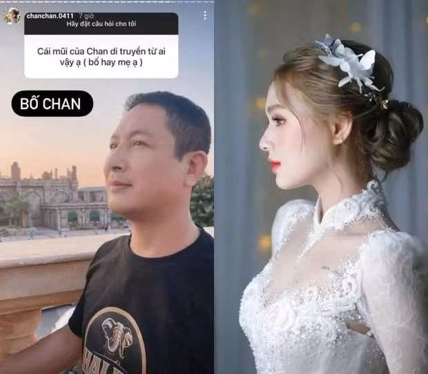 Nét gen trội được fan nhận định rằng Xoài Non thừa hưởng trọn vẹn từ bố mẹ, đặc biệt là sống mũi cao như Tây, đôi mắt sâu quyến rũ.