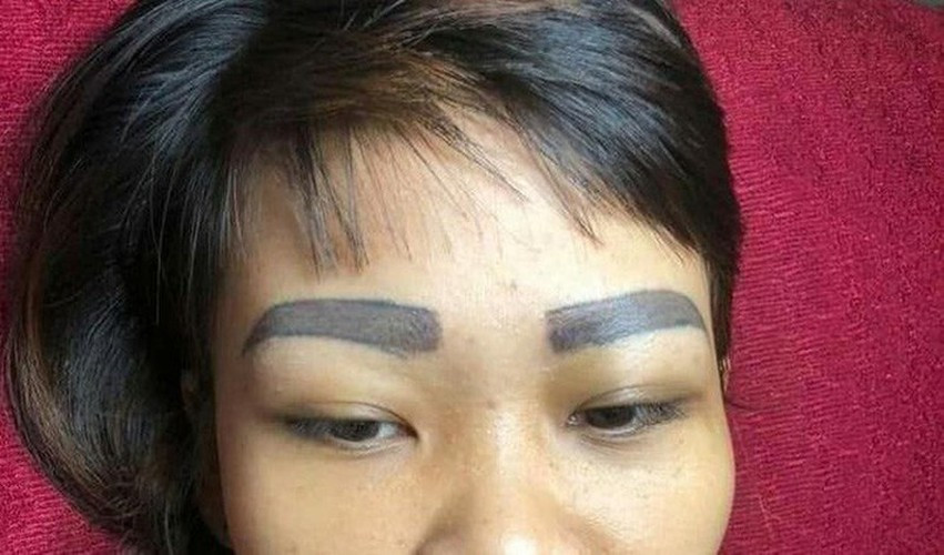 Sau sự việc của người phụ nữ, bác sĩ thẩm mỹ cũng khuyên mọi người khi làm đẹp cần chọn cơ sở có uy tín, các trang thiết bị sử dụng cũng cần theo đúng tiêu chuẩn, đặc biệt đi tân trang nhan sắc phải ở trong trạng thái tỉnh táo nhất, nếu không sẽ để lại hậu quả nặng nề, tiền mất tật mang.