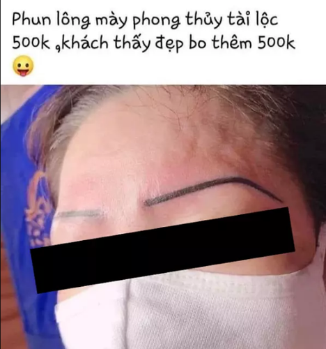 Nhưng để được đẹp và hoàn hảo nhất thì thời gian sửa lại sẽ khá lâu, mỗi tháng laser một lần và cần đến 1 năm để nó hoàn hảo nhất.