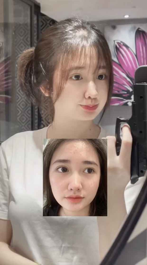 Giống như nhiều bạn nữ khác, nàng hot girl mạng này cũng có những lúc lao đao vì mặt mụn lấm tấm.