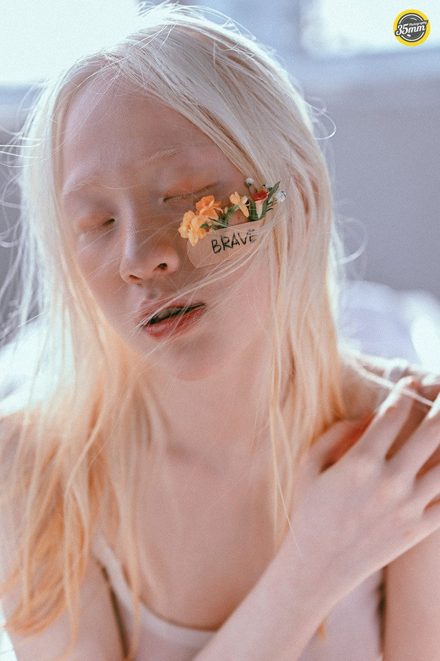 Bố mẹ Quỳnh cũng rất tâm lý, thường xuyên quan tâm con gái bằng những lời động viên, khích lệ chân thành để nữ sinh bạch tạng có thêm động lực cố gắng.