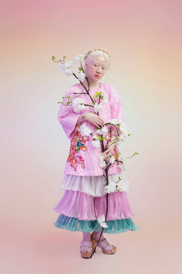 Thúy Quỳnh từng tâm sự rằng nhiều người đã tìm đến cô để chia sẻ khó khăn. Trong đó, có cả những cô, cậu bé cũng mắc bệnh bạch tạng như cô nàng.