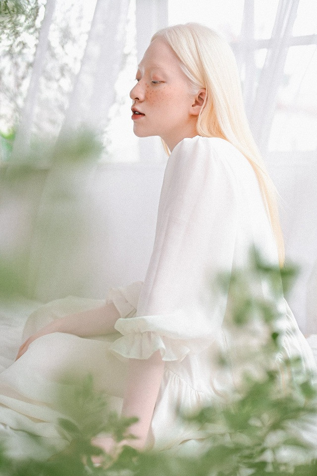 Nhờ có tình cảm của gia đình và bạn bè, Thúy Quỳnh ngày càng trở nên mạnh mẽ, cởi mở và sống tích cực hơn. 9X thú nhận bản thân mình vô cùng may mắn vì luôn được họ sát cánh bên cạnh.